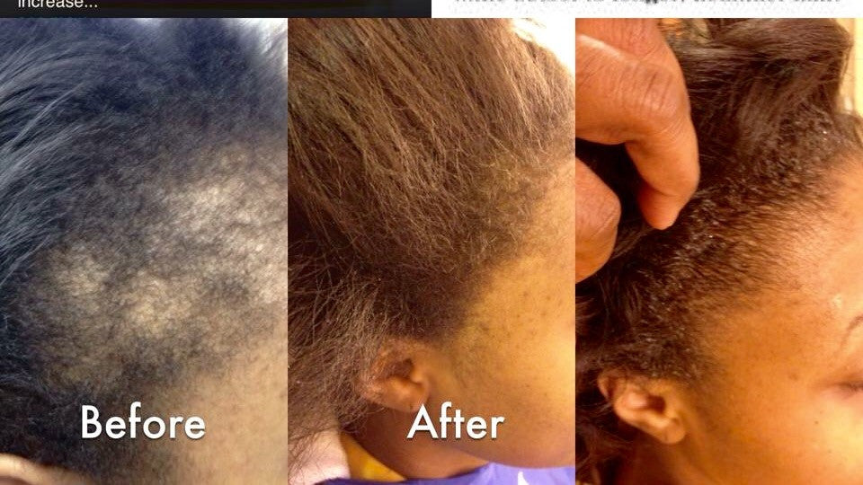 Stimulating Hair Growth System - divabycindy